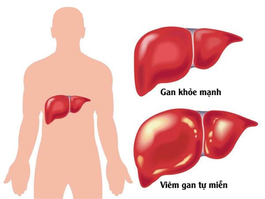 công dụng của diệp hạ châu tươi tại tphcm công dụng của diệp hạ châu tươi tại tphcm